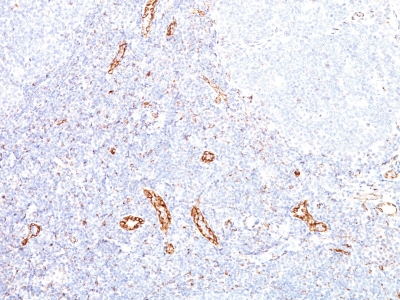 Formalin-fixed, paraffin embedded human tonsil sections stained with 100 ul anti-VEGF (clone VEGF/1063) at 1:100. HIER epitope retrieval prior to staining was performed in 10mM Tris 1mM EDTA, pH 9.0.